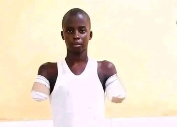 CHILDREN'S DAY: Gombe NBA Condemns 12-Year-Old’s Amputation Over Phone Theft