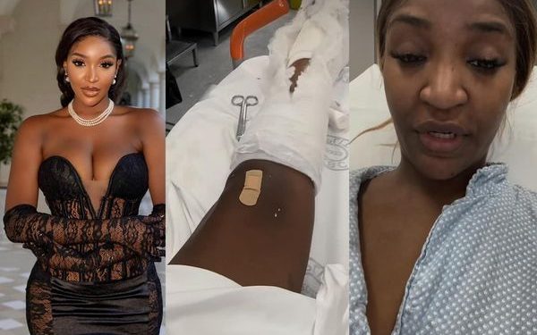Actress Idia Aisien Survives Severe Accident on Her Birthday in Croatia