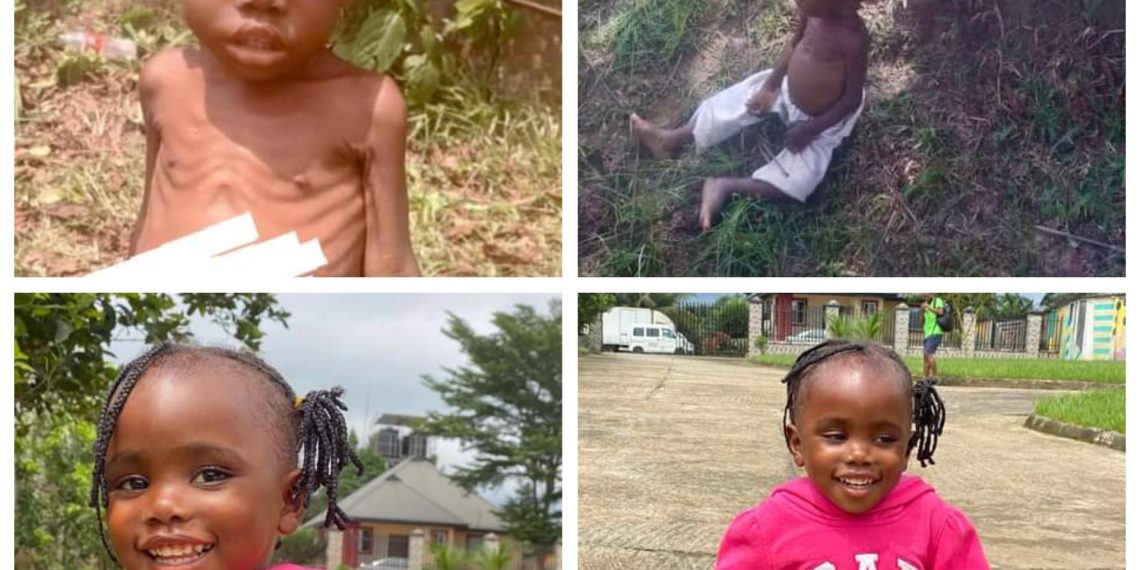 Amazing Transformation of Toddler Accused of Witchcraft and Left to Die in Akwa Ibom