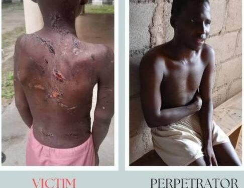 Teacher Arrested Over Brutal, Inhuman Treatment of Pupil