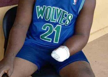 Kidnappers Chop Off Victims’ Hands, Release Them Without Ransom in Kogi