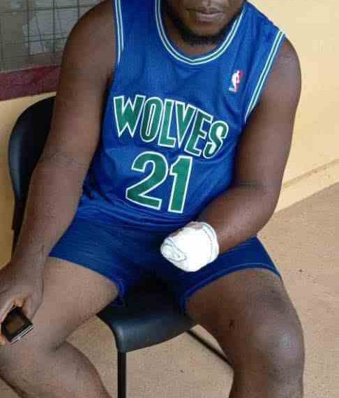 Kidnappers Chop Off Victims’ Hands, Release Them Without Ransom in Kogi