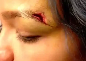 Cassie Tenders Photos of Gruesome Injuries from Ex-Boyfriend Diddy's Beatings