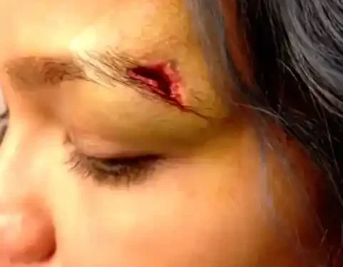 Cassie Tenders Photos of Gruesome Injuries from Ex-Boyfriend Diddy's Beatings