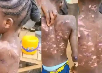 FCT CP Orders Arrest of Woman Accused of Burning Her Maid