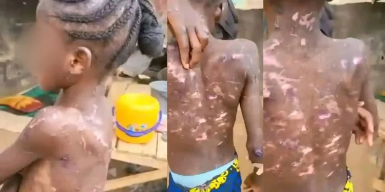 FCT CP Orders Arrest of Woman Accused of Burning Her Maid