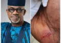 DSS Officer Beaten at Abiodun's 'Kangaroo' Endorsement Meeting as Political Violence Rocks Ogun East