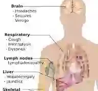 Understanding Cancer: Simple Ways to Prevent It and Why Early Detection Matters