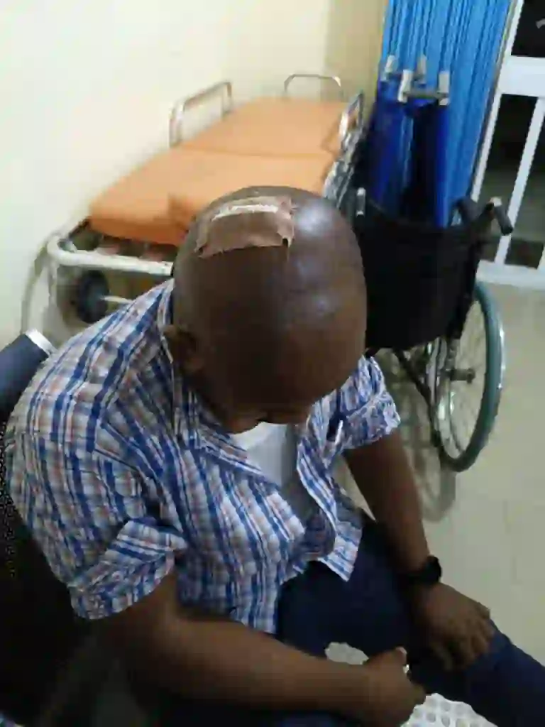 AEDC Officials Injured During Anti-Power Theft Operation at Dawaki Police Quarters