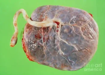 Dried placenta may help men regain erections faster after prostate surgery – Study